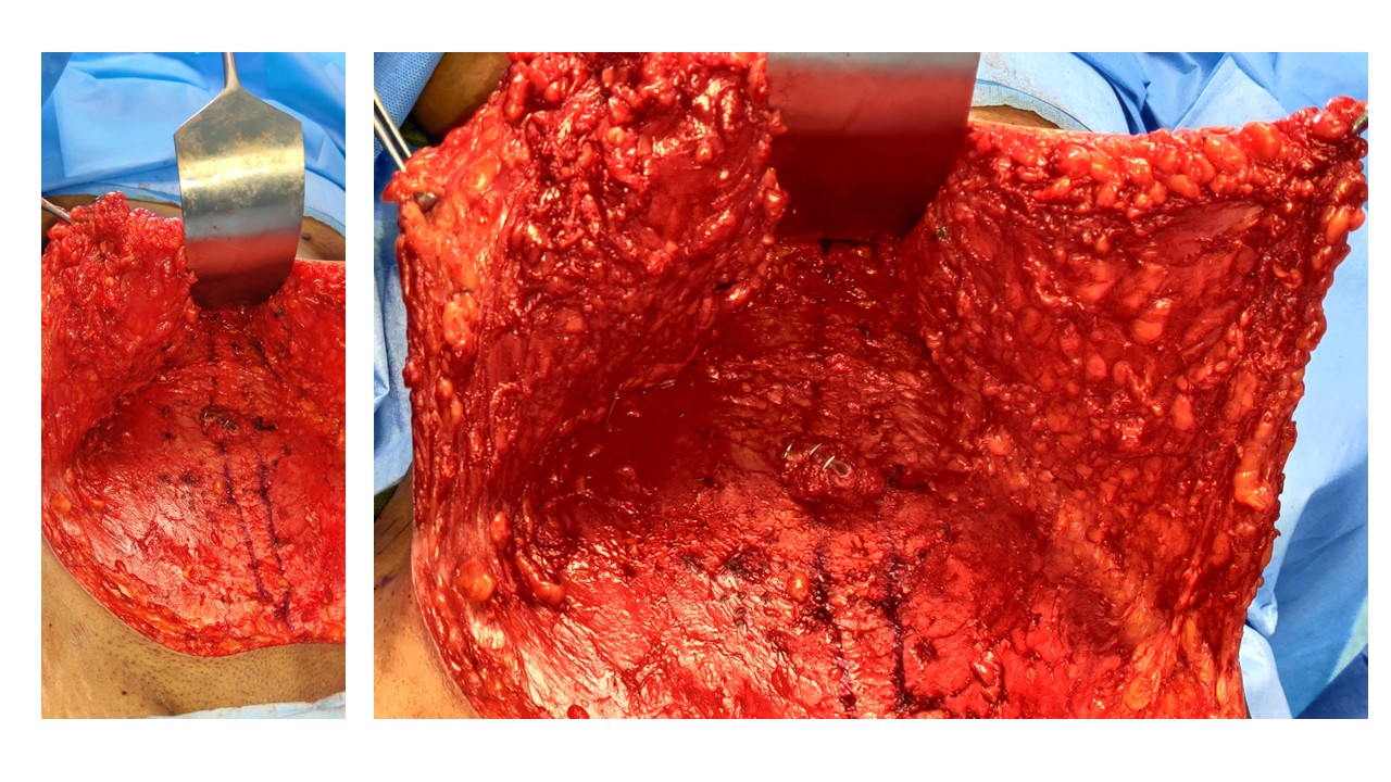 Suvarna Talk Photo 4